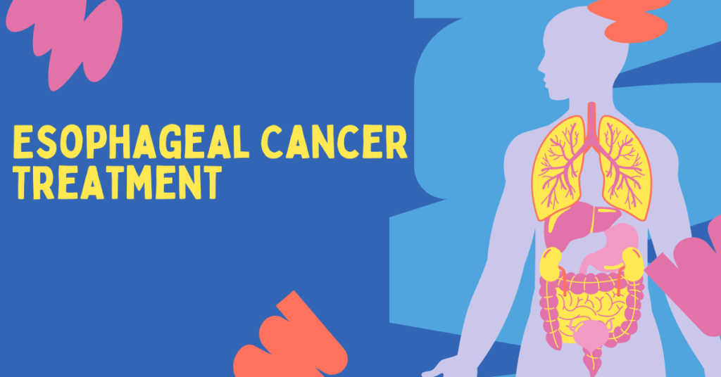 Esophageal Cancer Treatment Guidelines: A Comprehensive Overview